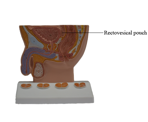 Rectovesical Pouch
